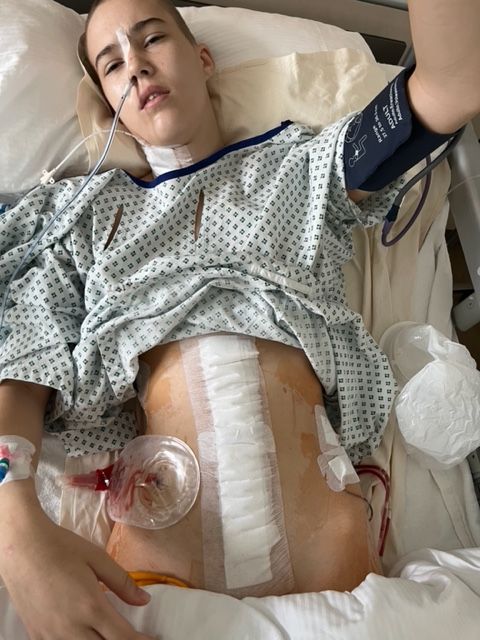 Taylor is lying in a hospital bed after abdominopelvic surgery with her hospital gown hitched up to show her bandaged incisions and drains.